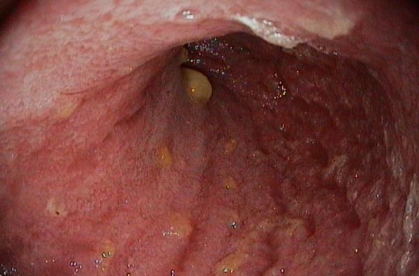 un intestino 3d cultivado en el laboratorio regenera la mucosa intestinal en perros un intestino 3d cultivado en el laboratorio regenera la mucosa intestinal en perros