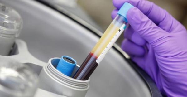 medyvet apuesta por el sistema endoret de prgf factores de crecimiento medyvet apuesta por el sistema endoret de prgf factores de crecimiento