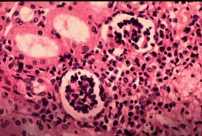 el paraacutesito de la leishmania boicotea la respuesta inmune el paraacutesito de la leishmania boicotea la respuesta inmune